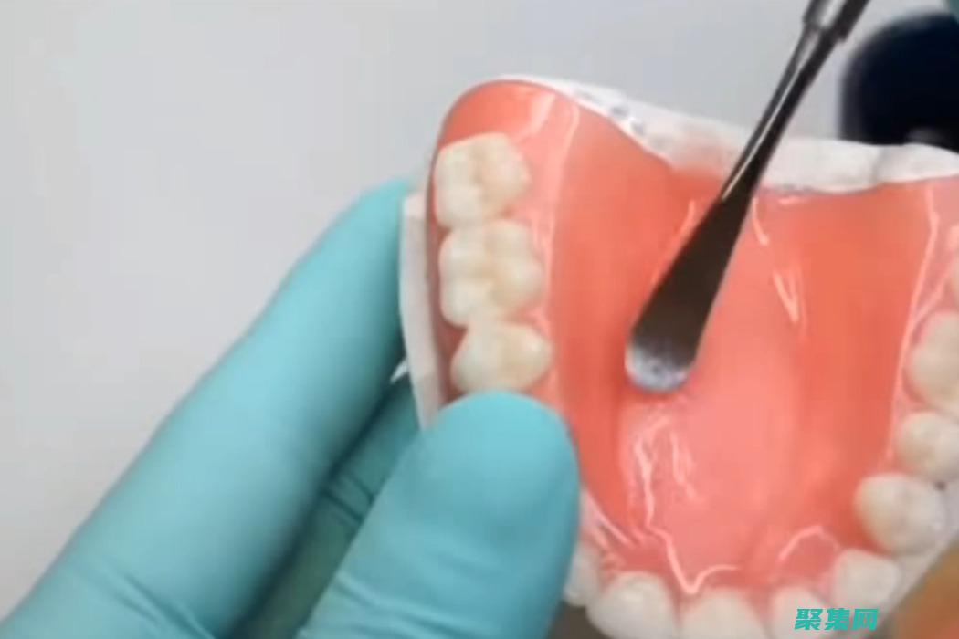 及時修復Kindeditor漏洞