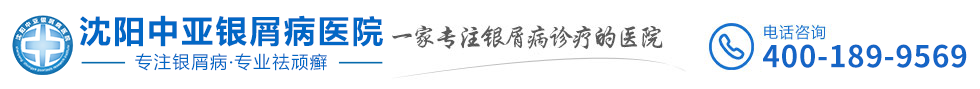 沈陽銀屑病醫院推薦-沈陽銀屑病醫院哪家好十大排名-沈陽中亞銀屑病醫院